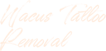 The Youth Tattoo Removal